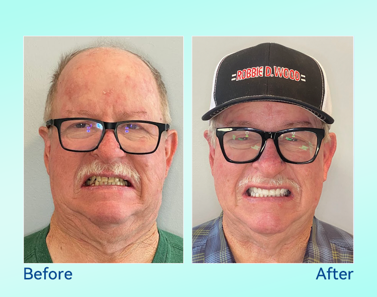 🔥 Only 4 boxes left! Enjoy an extra 50% off! Recommended by dentists, 𝐁𝐢𝐤𝐞𝐧𝐝𝐚® ensures your oral health so you can enjoy meals safely and naturally. Don’t miss out—act now or wait until next year! Enhance your oral health today!