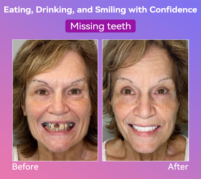 𝐉𝐚𝐬𝐬𝐞𝐞𝐦® Latest Premium Comfort Dentures🎁 (High-End Dentures, Easy to Wear - Limited Time 70% Discount)