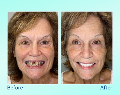 🔥 Only 4 boxes left! Enjoy an extra 50% off! Recommended by dentists, 𝐁𝐢𝐤𝐞𝐧𝐝𝐚® ensures your oral health so you can enjoy meals safely and naturally. Don’t miss out—act now or wait until next year! Enhance your oral health today!