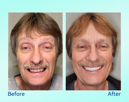 🔥 Only 4 boxes left! Enjoy an extra 50% off! Recommended by dentists, 𝐁𝐢𝐤𝐞𝐧𝐝𝐚® ensures your oral health so you can enjoy meals safely and naturally. Don’t miss out—act now or wait until next year! Enhance your oral health today!