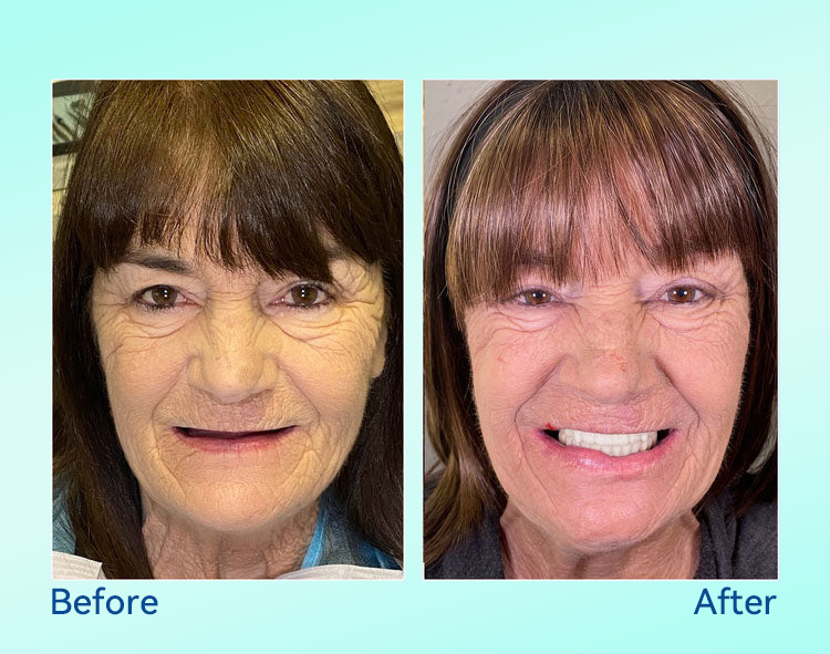 🔥 Only 4 boxes left! Enjoy an extra 50% off! Recommended by dentists, 𝐁𝐢𝐤𝐞𝐧𝐝𝐚® ensures your oral health so you can enjoy meals safely and naturally. Don’t miss out—act now or wait until next year! Enhance your oral health today!