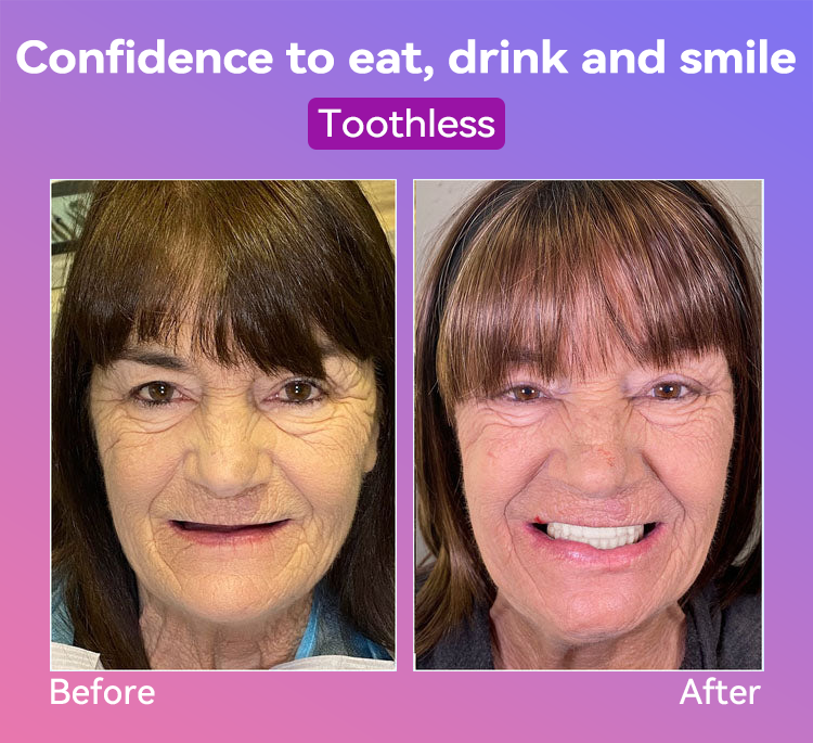 𝐉𝐚𝐬𝐬𝐞𝐞𝐦® Latest Premium Comfort Dentures🎁 (High-End Dentures, Easy to Wear - Limited Time 70% Discount)