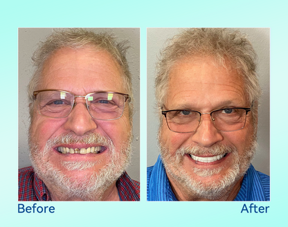 🔥 Only 4 boxes left! Enjoy an extra 50% off! Recommended by dentists, 𝐁𝐢𝐤𝐞𝐧𝐝𝐚® ensures your oral health so you can enjoy meals safely and naturally. Don’t miss out—act now or wait until next year! Enhance your oral health today!