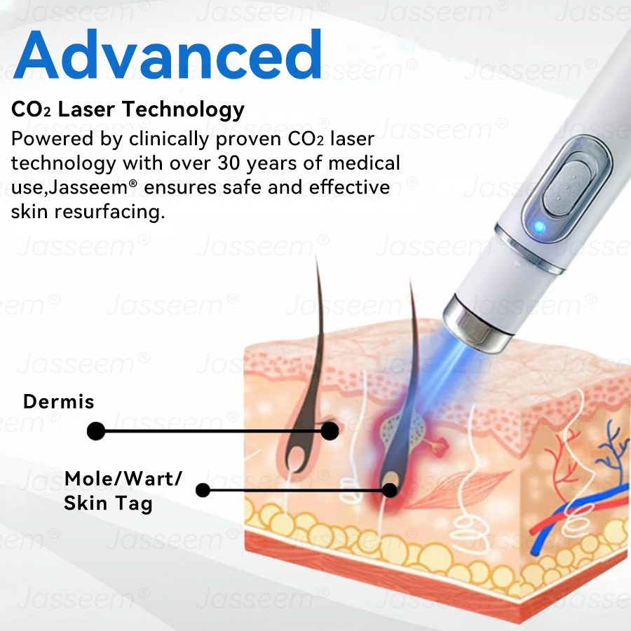 𝐉𝐚𝐬𝐬𝐞𝐞𝐦® ✅✅𝐍𝐨𝐧-𝐈𝐧𝐯𝐚𝐬𝐢𝐯𝐞 𝐌𝐨𝐥𝐞 & 𝐖𝐚𝐫𝐭 𝐋𝐚𝐬𝐞𝐫 𝐑𝐞𝐦𝐨𝐯𝐚𝐥 𝐏𝐞𝐧 (𝐩𝐚𝐢𝐧𝐥𝐞𝐬𝐬 𝐫𝐞𝐦𝐨𝐯𝐚𝐥 𝐨𝐟 𝐰𝐚𝐫𝐭𝐬, 𝐦𝐨𝐥𝐞𝐬, 𝐚𝐠𝐞 𝐬𝐩𝐨𝐭𝐬, 𝐚𝐧𝐝 𝐬𝐤𝐢𝐧 𝐭𝐚𝐠𝐬)