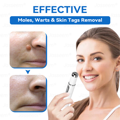 𝐉𝐚𝐬𝐬𝐞𝐞𝐦® ✅✅𝐍𝐨𝐧-𝐈𝐧𝐯𝐚𝐬𝐢𝐯𝐞 𝐌𝐨𝐥𝐞 & 𝐖𝐚𝐫𝐭 𝐋𝐚𝐬𝐞𝐫 𝐑𝐞𝐦𝐨𝐯𝐚𝐥 𝐏𝐞𝐧 (𝐩𝐚𝐢𝐧𝐥𝐞𝐬𝐬 𝐫𝐞𝐦𝐨𝐯𝐚𝐥 𝐨𝐟 𝐰𝐚𝐫𝐭𝐬, 𝐦𝐨𝐥𝐞𝐬, 𝐚𝐠𝐞 𝐬𝐩𝐨𝐭𝐬, 𝐚𝐧𝐝 𝐬𝐤𝐢𝐧 𝐭𝐚𝐠𝐬)
