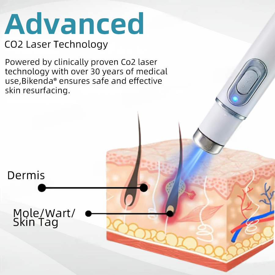 𝐁ik𝐞nd𝐚® ✅✅N𝐨n-inv𝐚siv𝐞 𝐌𝐨l𝐞 and W𝐚rt 𝐑𝐞m𝐨v𝐚l L𝐚s𝐞r 𝐏𝐞n 𝐏r𝐨m𝐚x
