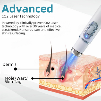 𝐁ik𝐞nd𝐚® ✅✅N𝐨n-inv𝐚siv𝐞 𝐌𝐨l𝐞 and W𝐚rt 𝐑𝐞m𝐨v𝐚l L𝐚s𝐞r 𝐏𝐞n 𝐏r𝐨m𝐚x