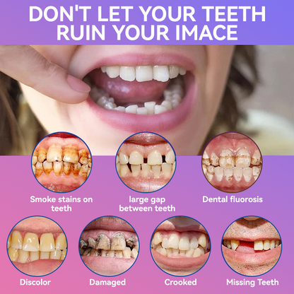 𝐉𝐚𝐬𝐬𝐞𝐞𝐦® Latest Premium Comfort Dentures🎁 (High-End Dentures, Easy to Wear - Limited Time 70% Discount)