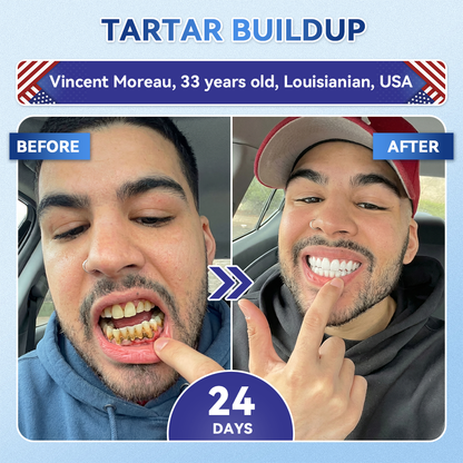 𝐺𝑙𝑖𝑚𝑚𝑒𝑟𝑙𝑦® 𝑇𝑖𝑑𝑒𝑔𝑙𝑢𝑠𝑖𝑏 𝑇𝑜𝑜𝑡ℎ & 𝐺𝑢𝑚 𝑅𝑒𝑝𝑎𝑖𝑟 𝐹𝑎𝑠𝑡-𝐷𝑖𝑠𝑠𝑜𝑙𝑣𝑖𝑛𝑔 𝑂𝑟𝑎𝑙 𝑆𝑡𝑟𝑖𝑝𝑠