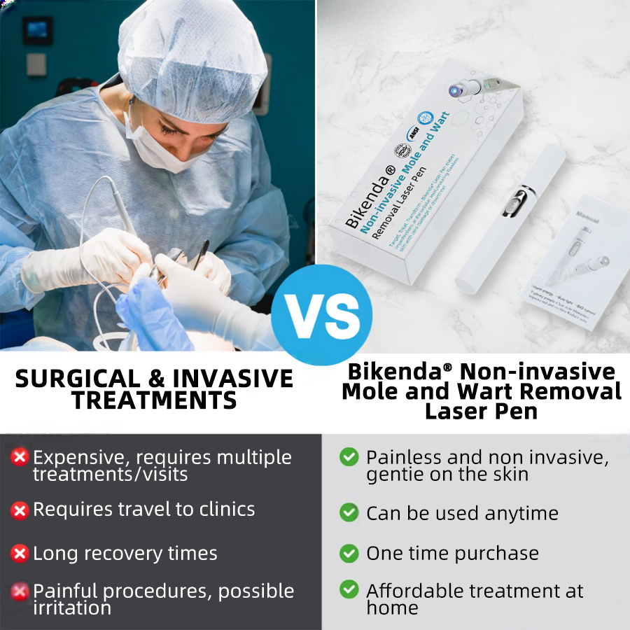 𝐁ik𝐞nd𝐚® ✅✅N𝐨n-inv𝐚siv𝐞 𝐌𝐨l𝐞 and W𝐚rt 𝐑𝐞m𝐨v𝐚l L𝐚s𝐞r 𝐏𝐞n 𝐏r𝐨m𝐚x