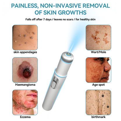 𝐉𝐚𝐬𝐬𝐞𝐞𝐦® Medical-Grade Laser Pen 💕 (Powered by CO₂ laser technology – effectively removes moles, warts, skin tags, pigmentation spots, and other skin imperfections)🏆
