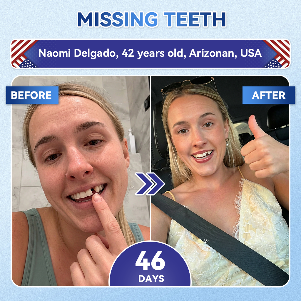 𝐺𝑙𝑖𝑚𝑚𝑒𝑟𝑙𝑦® 𝑇𝑖𝑑𝑒𝑔𝑙𝑢𝑠𝑖𝑏 𝑇𝑜𝑜𝑡ℎ & 𝐺𝑢𝑚 𝑅𝑒𝑝𝑎𝑖𝑟 𝐹𝑎𝑠𝑡-𝐷𝑖𝑠𝑠𝑜𝑙𝑣𝑖𝑛𝑔 𝑂𝑟𝑎𝑙 𝑆𝑡𝑟𝑖𝑝𝑠