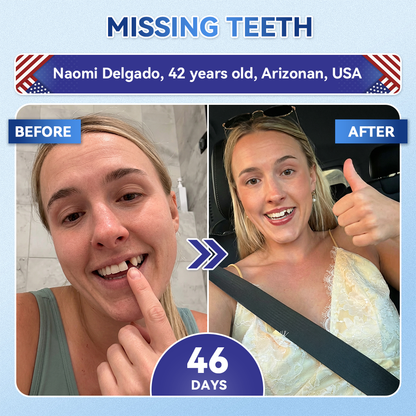 𝐺𝑙𝑖𝑚𝑚𝑒𝑟𝑙𝑦® 𝑇𝑖𝑑𝑒𝑔𝑙𝑢𝑠𝑖𝑏 𝑇𝑜𝑜𝑡ℎ & 𝐺𝑢𝑚 𝑅𝑒𝑝𝑎𝑖𝑟 𝐹𝑎𝑠𝑡-𝐷𝑖𝑠𝑠𝑜𝑙𝑣𝑖𝑛𝑔 𝑂𝑟𝑎𝑙 𝑆𝑡𝑟𝑖𝑝𝑠