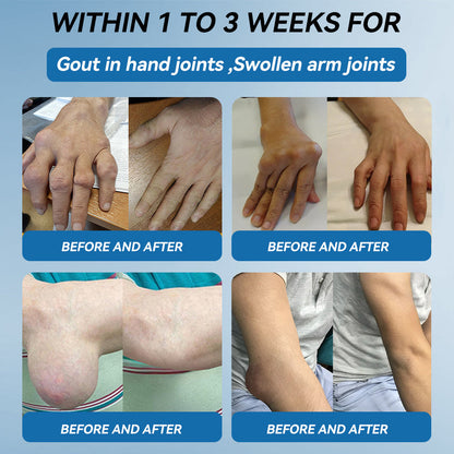 Picdo® BPC-157 Joint Healing Cream 🎁🎁