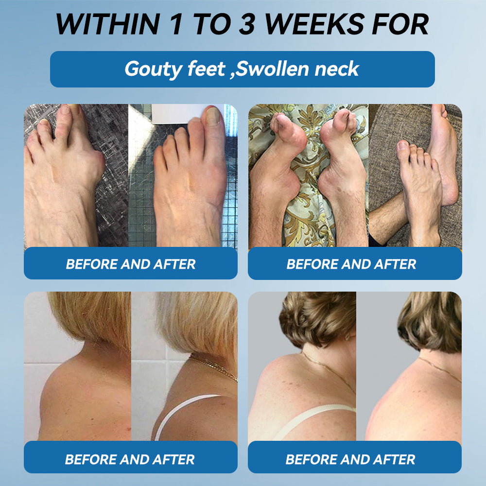 Picdo® BPC-157 Joint Healing Cream 🎁🎁