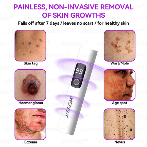 𝐉𝐚𝐬𝐬𝐞𝐞𝐦® 🔥𝐀𝐝𝐯𝐚𝐧𝐜𝐞𝐝 𝐍𝐨𝐧-𝐢𝐧𝐯𝐚𝐬𝐢𝐯𝐞 𝐒𝐤𝐢𝐧 𝐑𝐞𝐩𝐚𝐢𝐫 𝐂𝐎₂ 𝐋𝐚𝐬𝐞𝐫 𝐏𝐞𝐧(Gently gets rid of warts, moles, age spots, and skin tags – no pain, no fuss!)