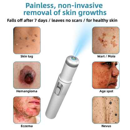 𝐁ik𝐞nd𝐚® ✅✅N𝐨n-inv𝐚siv𝐞 𝐌𝐨l𝐞 and W𝐚rt 𝐑𝐞m𝐨v𝐚l L𝐚s𝐞r 𝐏𝐞n 𝐏r𝐨m𝐚x